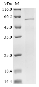 Mumps virus Hemagglutinin-neuraminidase Protein