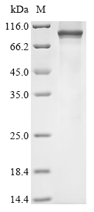 Rat Trpv2 Protein