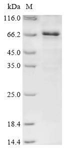 Newcastle disease virus Hemagglutinin-neuraminidase Protein