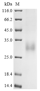 Human GLP2R Protein