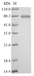 Human HNRNPA2B1 Protein