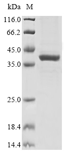 Human QPCT Protein
