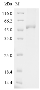 Human TRIM21 Protein