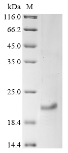 Human TNNC1 Protein