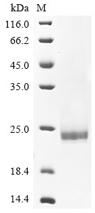 Hepatitis B virus genotype A2 subtype adw2 Capsid Protein