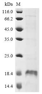 Human MAP1LC3B Protein