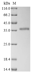 Human HNRNPA2B1 Protein