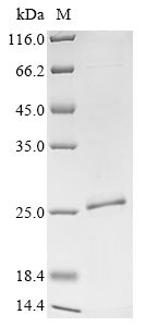 Aequorea victoria Aequorin-1 Protein