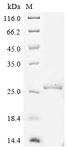 Rat Prolactin Protein