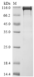 Human SMARCA2 Protein (Biotin)
