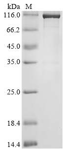 Human SMARCA4 Protein (Biotin)