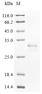 Human HPRT1 Protein