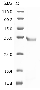Human HPRT1 Protein