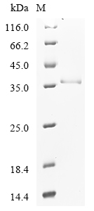 Hepatitis B virus genotype A2 subtype adw2 Capsid Protein