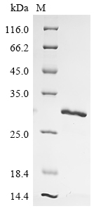 Hepatitis B virus genotype A2 subtype adw2 Capsid Protein