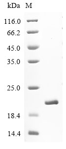 Human MAP1LC3B Protein