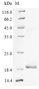 Human TNNC1 Protein