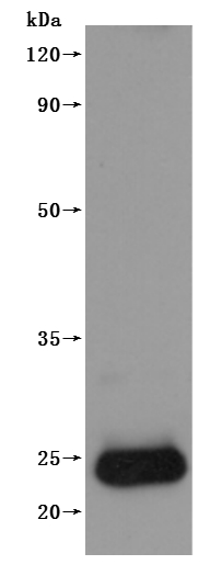Human CLDN4-VLPs Protein
