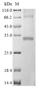 Mouse Aqp4 Protein