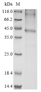 Mouse Ccr1 Protein