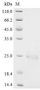 Human Complement component C8 gamma chain Protein