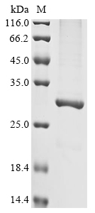 Clostridium acetobutylicum Acetoacetate decarboxylase Protein
