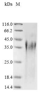 Yeast SAP2 Protein