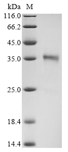 Human HPRT1 Protein