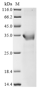 Human HPRT1 Protein