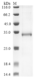 Human CHRM3 Protein