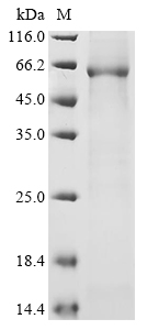 Human SRR Protein