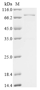 Human VHL Protein (Biotin)