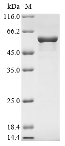 Human GFAP Protein