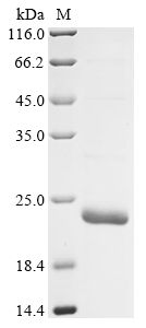 Mouse Irag1 Protein