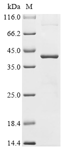 Human NPM1 Protein