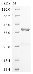 Human SNRPA Protein