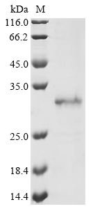 Aequorea victoria Aequorin-1 Protein