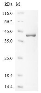 Human Varicella-zoster virus Envelope glycoprotein B Protein