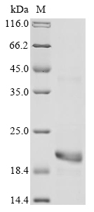 Dendroaspis angusticeps Natriuretic peptide DNP Protein