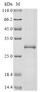 Recombinant Coxiella burnetii Chaperonin GroEL (groEL), partial