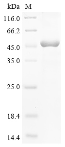 Human NMI Protein