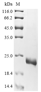 Human TARDBP Protein