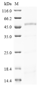 Human PAH Protein