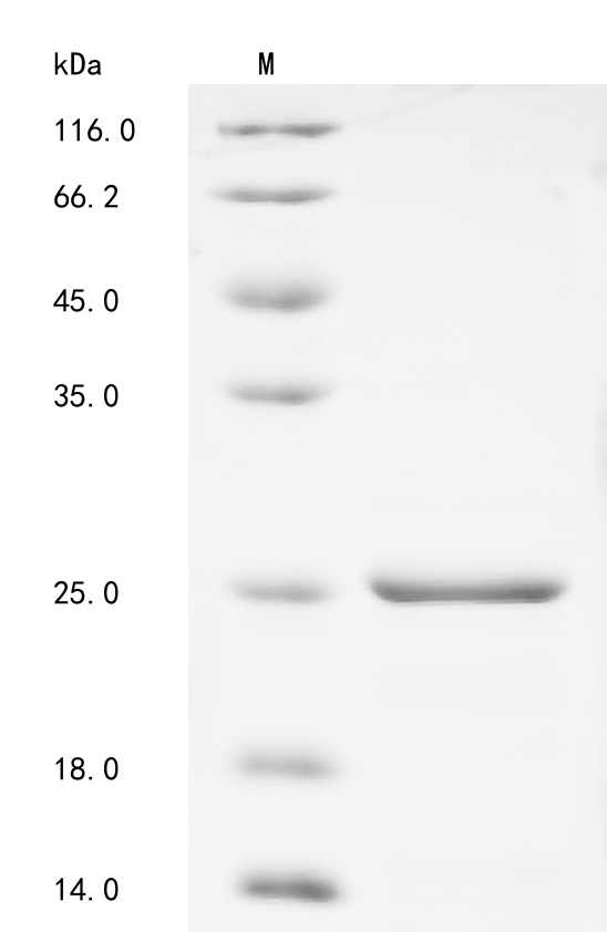 Human SNCB Protein