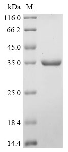 Clostridium acetobutylicum Acetoacetate decarboxylase Protein