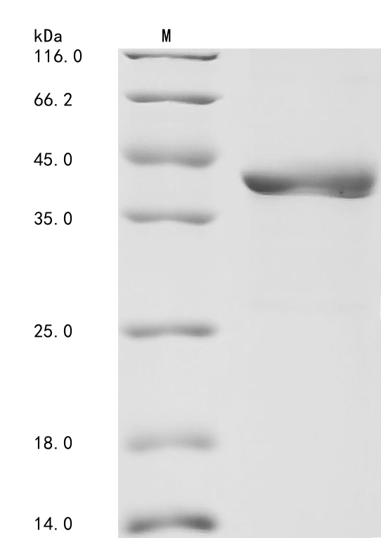 Human GGH Protein
