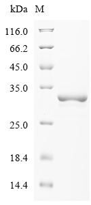 Clostridium acetobutylicum Acetoacetate decarboxylase Protein