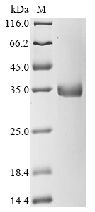 Human NEUROG3 Protein
