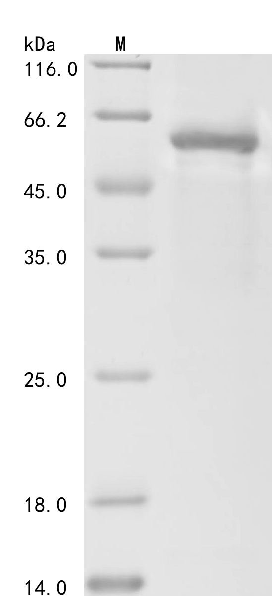 Human FSHR Protein