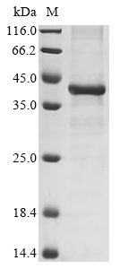 Human IL17A Protein